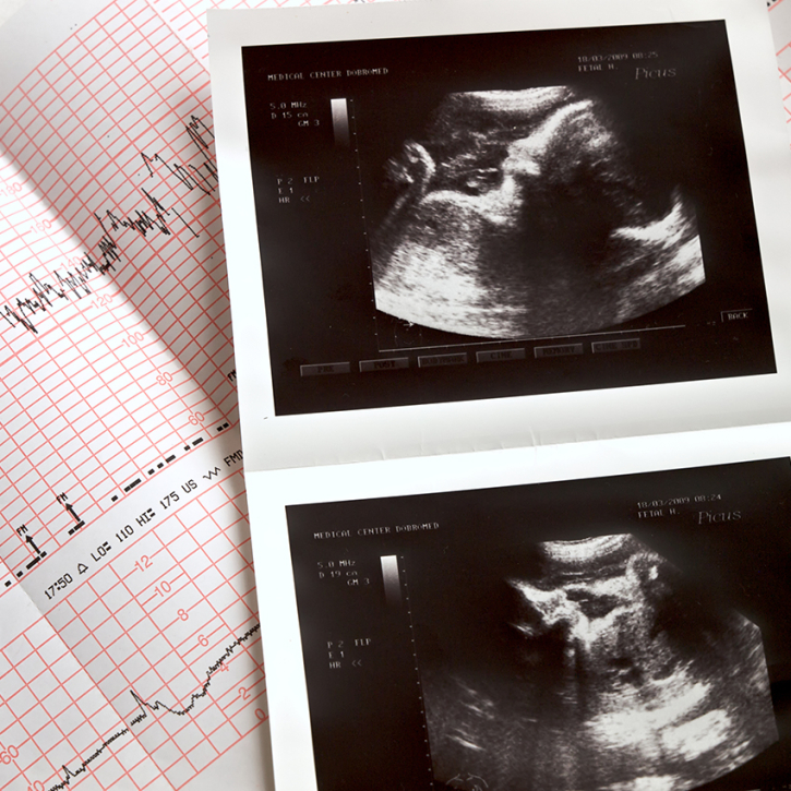 Progesteron.de | Schwanger werden